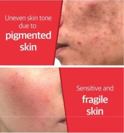 Snail Truecica Miracle Repair Toner (150ml) -Glow Skincare Store SOME BY MI Snail Truecica Miracle Repair Toner 3