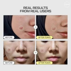 Snail Mucin 95 + Peptide Facial Essence (140ml) -Glow Skincare Store SnailMucin95 PeptideFacialEssence 140ml 5