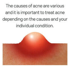 AC Fighting PHA 12 Purifying Liquid (80ml) -Glow Skincare Store TiamACFightingPHA12PurifyingLiquid 80ml 3